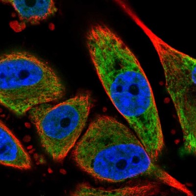 Immunocytochemistry/Immunofluorescence: SEC61B Antibody [NBP2-13290] - Immunofluorescent staining of human cell line PC-3 shows localization to endoplasmic reticulum.