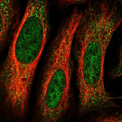 Immunocytochemistry/Immunofluorescence: KIAA1984 Antibody [NBP1-94134] - Staining of human cell line U-2 OS shows positivity in nucleus but not nucleoli and cytoplasm.