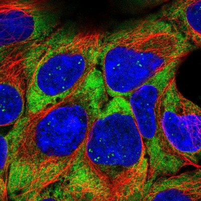 Immunocytochemistry/Immunofluorescence: RPL21 Antibody [NBP2-13252] - Immunofluorescent staining of human cell line HEK 293 shows localization to nucleoli fibrillar center, cytosol & endoplasmic reticulum.