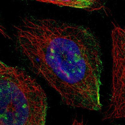 Immunocytochemistry/Immunofluorescence: SIT1 Antibody [NBP2-13311] Staining of human cell line A-431 shows positivity in nucleoli and plasma membrane.