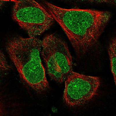 Immunofluorescence: AMPD3 Antibody [NBP2-14290] - Immunofluorescent staining of human cell line U-2 OS shows localization to nucleoli & nuclear membrane. Antibody staining is shown in green.