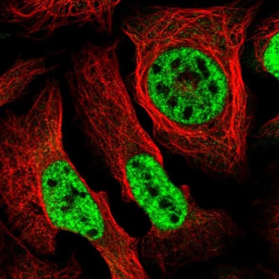 Immunocytochemistry/Immunofluorescence: SEPHS2 Antibody [NBP2-13293] - Staining of human cell line U-2 OS shows positivity in nucleus but not nucleoli.