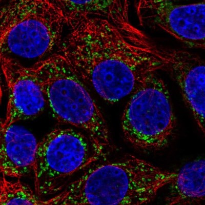 Immunocytochemistry/Immunofluorescence: HADHA Antibody [NBP2-54988] - Staining of human cell line MCF7 shows localization to mitochondria.