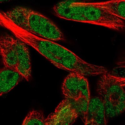 Immunocytochemistry/Immunofluorescence: SMC6L1 Antibody [NBP2-55146] - Staining of human cell line RH-30 shows localization to nucleoplasm.