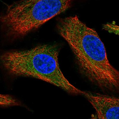 Immunocytochemistry/Immunofluorescence: DPS Antibody [NBP2-55185] - Staining of human cell line A549 shows localization to cytosol.