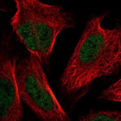 Immunocytochemistry/Immunofluorescence: NSMCE4A Antibody [NBP2-55189] - Staining of human cell line U-2 OS shows localization to nucleoplasm.