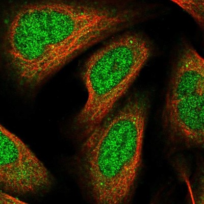 Immunocytochemistry/Immunofluorescence: RHOBTB1 Antibody [NBP2-55210] - Staining of human cell line U-2 OS shows localization to nucleoplasm & cytosol.