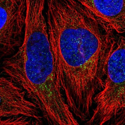Immunocytochemistry/Immunofluorescence: CLIP4 Antibody [NBP2-55452] - Staining of human cell line HeLa shows localization to vesicles.