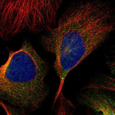 Immunocytochemistry/Immunofluorescence: WHAMM Antibody [NBP1-89593] - Staining of human cell line U-2 OS shows positivity in cytoplasm.