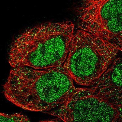 Immunocytochemistry/Immunofluorescence: RNF12 Antibody [NBP1-89571] - Staining of human cell line A-431 shows positivity in nucleus but not nucleoli and cytoplasm.