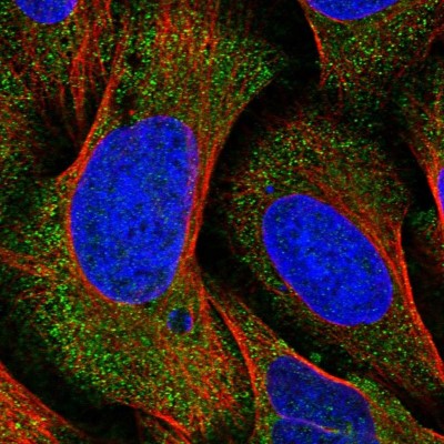 Immunocytochemistry/Immunofluorescence: ANAPC16 Antibody [NBP1-89048] - Immunofluorescent staining of human cell line U-2 OS shows localization to cytosol.