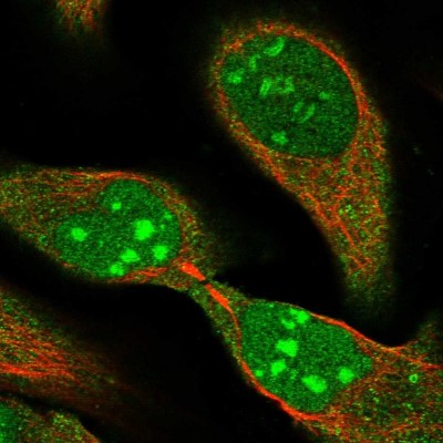 Immunocytochemistry/Immunofluorescence: HUCE1 Antibody [NBP1-89618] - Immunofluorescent staining of human cell line U-2 OS shows localization to nucleus, nucleoli & cytosol.