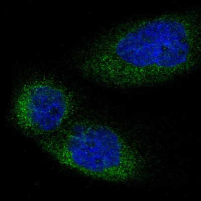Immunocytochemistry/Immunofluorescence: LMBR1 Antibody [NBP1-89276] - Staining of human cell line A-431 shows positivity in cytoplasm.