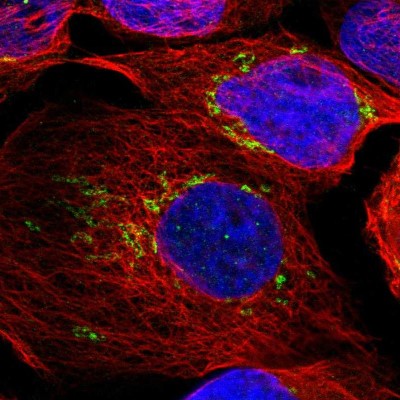 Immunocytochemistry/Immunofluorescence: TXNDC15 Antibody [NBP1-89394] - Immunofluorescent staining of human cell line A-431 shows localization to the Golgi apparatus.