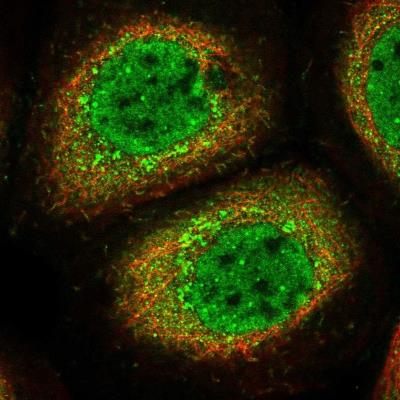 Immunocytochemistry/Immunofluorescence: SOBP Antibody [NBP1-90442] - Staining of human cell line A-431 shows positivity in nucleus but not nucleoli and vesicles.