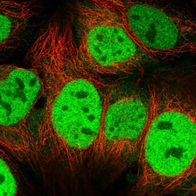 Immunocytochemistry/Immunofluorescence: CSE1L/CAS/Exportin-2 Antibody [NBP2-38384] - Staining  of human cell line CACO-2 shows positivity in cytoplasm and nucleus but excluded from the nucleoli.