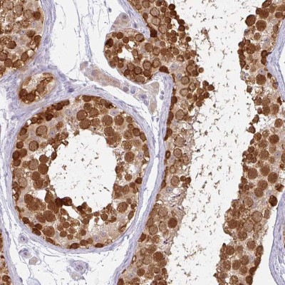 Immunohistochemistry: CSE1L/CAS/Exportin-2 Antibody [NBP2-38384] - Staining of human testis shows strong cytoplasmic and nuclear positivity in cells in seminiferus ducts.