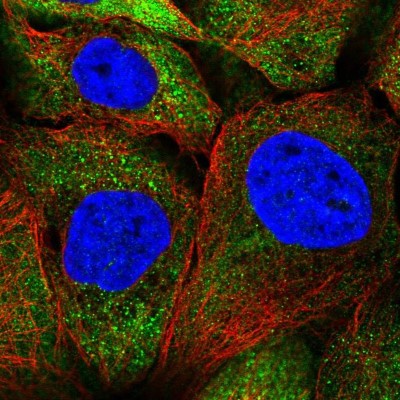 Immunocytochemistry/Immunofluorescence: SEPN1 Antibody [NBP2-34098] - Immunofluorescent staining of human cell line A-431 shows localization to cytosol.
