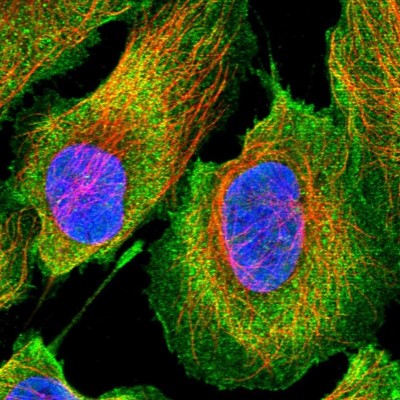 Immunocytochemistry/Immunofluorescence: ethanolamine kinase Antibody [NBP2-33918] - Immunofluorescent staining of human cell line U-2 OS shows localization to plasma membrane & cytosol.