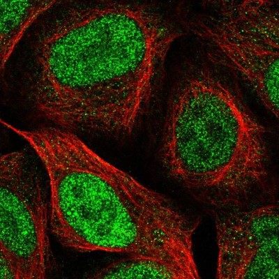 Immunocytochemistry/Immunofluorescence: PPM1H Antibody [NBP2-38859] - Staining of human cell line U-2 OS shows localization to nucleoplasm.