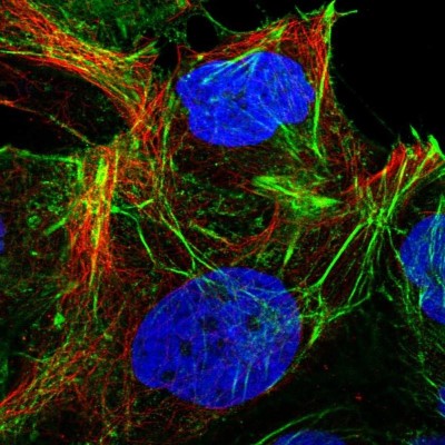 Immunocytochemistry/Immunofluorescence: CYP20A1 Antibody [NBP2-31614] - Staining of human cell line CACO-2 shows positivity in nucleoli, plasma membrane, actin filaments & cell junctions.