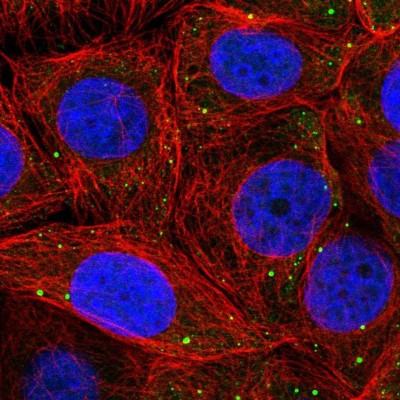 Immunocytochemistry/Immunofluorescence: PSMD6 Antibody [NBP2-32677] - Immunofluorescent staining of human cell line MCF7 shows localization to vesicles.