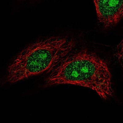 Immunocytochemistry/Immunofluorescence: ZNF336 Antibody [NBP1-92624] - Staining of human cell line A549 shows localization to nucleus & nucleoli.