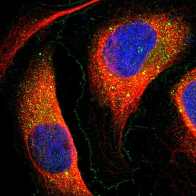 Immunocytochemistry/Immunofluorescence: TMEM166 Antibody [NBP1-92517] - Immunofluorescent staining of human cell line U-2 OS shows localization to plasma membrane & vesicles.