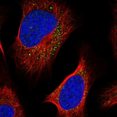 Immunocytochemistry/Immunofluorescence: LIPT2 Antibody [NBP1-91135] - Immunofluorescent staining of human cell line U-2 OS shows localization to vesicles.
