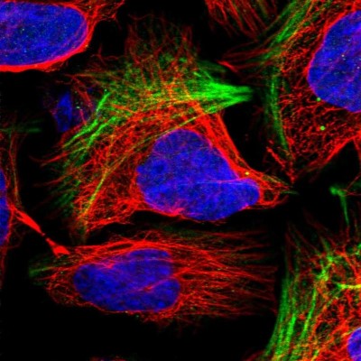 Immunocytochemistry/Immunofluorescence: LHFPL2 Antibody [NBP1-93654] - Immunofluorescent staining of human cell line U-2 OS shows localization to actin filaments & vesicles.