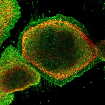 Immunocytochemistry/Immunofluorescence: Symplekin Antibody [NBP1-92464] - Immunofluorescent staining of human cell line A-431 shows localization to nucleoplasm, plasma membrane & cytosol.