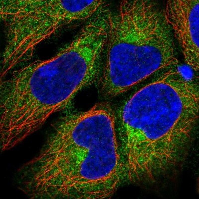 Immunocytochemistry/Immunofluorescence: ADTB1 Antibody [NBP2-57109] - Staining of human cell line HEK 293 shows localization to cytosol & the Golgi apparatus.