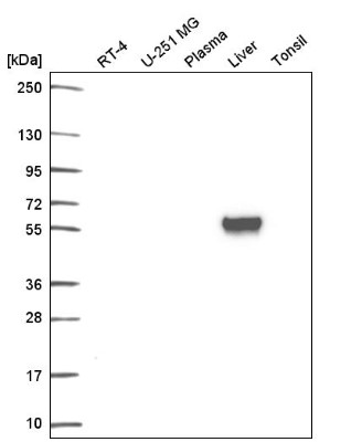 Western Blot: Lamin B Receptor Antibody [NBP2-56993] - Western blot analysis in human cell line RT-4, human cell line U-251 MG, human plasma, human liver tissue and human tonsil tissue.