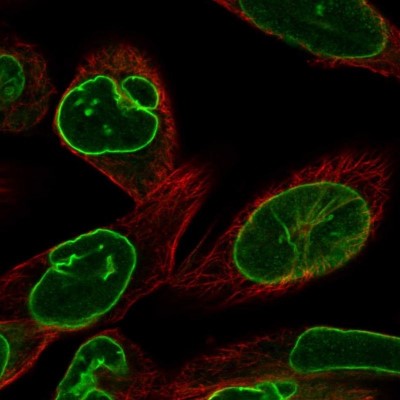 Immunocytochemistry/Immunofluorescence: Lamin B Receptor Antibody [NBP2-56993] - Staining of human cell line RH-30 shows localization to nuclear membrane.
