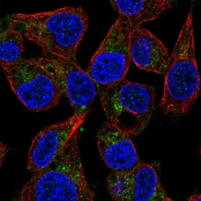 Immunocytochemistry/Immunofluorescence: PPAP2B Antibody [NBP2-57350] - Staining of human cell line Hep G2 shows localization to the Golgi apparatus.