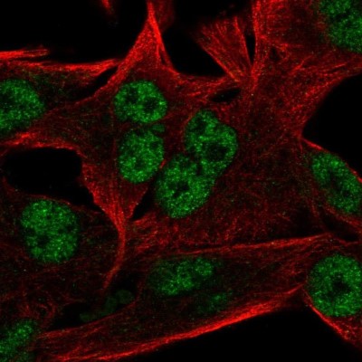 Immunocytochemistry/Immunofluorescence: RC74 Antibody [NBP2-57534] - Staining of human cell line SK-MEL-30 shows localization to nucleoplasm.