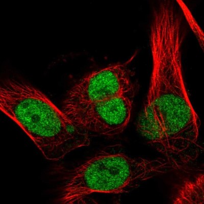 Immunocytochemistry/Immunofluorescence: RECQ1 Antibody [NBP2-57572] - Staining of human cell line U-251 MG shows localization to nucleoplasm.