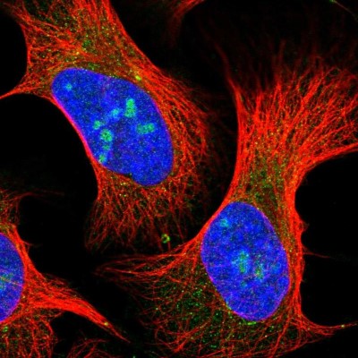 Immunocytochemistry/Immunofluorescence: AASDH Antibody [NBP1-89266] - Staining of human cell line U-2 OS shows positivity in nucleoli and cytoplasm.