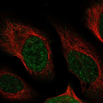 Immunocytochemistry/Immunofluorescence: NUDT13 Antibody [NBP1-92207] - Immunofluorescent staining of human cell line U-2 OS shows localization to nucleoplasm.