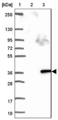 Western Blot: C17orf77 Antibody [NBP1-93881] - Lane 1: Marker [kDa] 250, 130, 95, 72, 55, 36, 28, 17, 10. Lane 2: Negative control (vector only transfected HEK293T lysate). Lane 3: Over-expression lysate (Co-expressed with a C-terminal myc-DDK tag (3.1 kDa) in mammalian HEK293T cells).