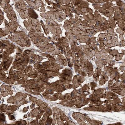 Immunohistochemistry: C17orf77 Antibody [NBP1-93881] - Staining of human heart muscle shows strong cytoplasmic and membranous positivity.