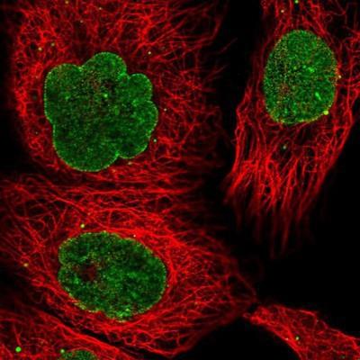 Immunocytochemistry/Immunofluorescence: POU6F1 Antibody [NBP2-13791] - Staining of human cell line A-431 shows positivity in nuclear membrane and vesicles.