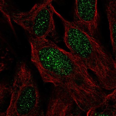 Immunocytochemistry/Immunofluorescence: C19orf44 Antibody [NBP2-58435] - Staining of human cell line U-2 OS shows localization to nucleus.