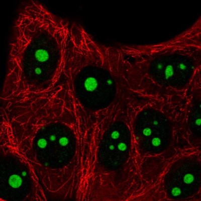Immunocytochemistry/Immunofluorescence: SETMAR Antibody [NBP2-58313] - Staining of human cell line MCF7 shows localization to nucleoli.