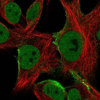 Immunocytochemistry/Immunofluorescence: SGCE Antibody [NBP2-57804] - Staining of human cell line SK-MEL-30 shows localization to nucleoplasm, plasma membrane & vesicles.