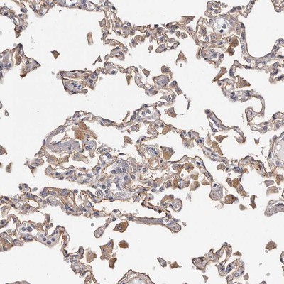 Immunohistochemistry-Paraffin: Thyroid receptor-interacting protein 13 Antibody [NBP1-90335] - Staining of human lung shows distinct membranous positivity in alveolar cells.