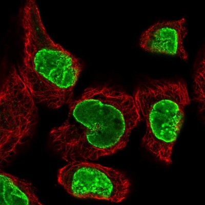 Immunocytochemistry/Immunofluorescence: TPR Antibody [NBP1-89448] - Immunofluorescent staining of human cell line A-431 shows localization to nuclear membrane.