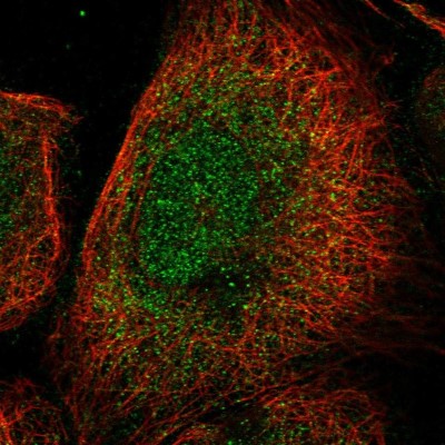 Immunocytochemistry/Immunofluorescence: HEPHL1 Antibody [NBP1-90512] - Staining of human cell line A-431 shows positivity in nucleus and cytoplasm.