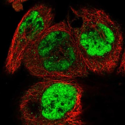 Immunocytochemistry/Immunofluorescence: FEM1B Antibody [NBP1-89422] - Staining of human cell line A-431 shows localization to nucleoplasm & cytosol.