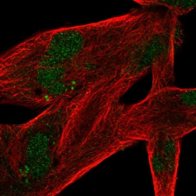 Immunocytochemistry/Immunofluorescence: MSANTD4 Antibody [NBP2-30663] - Immunofluorescent staining of human cell line RH-30 shows localization to nucleus.